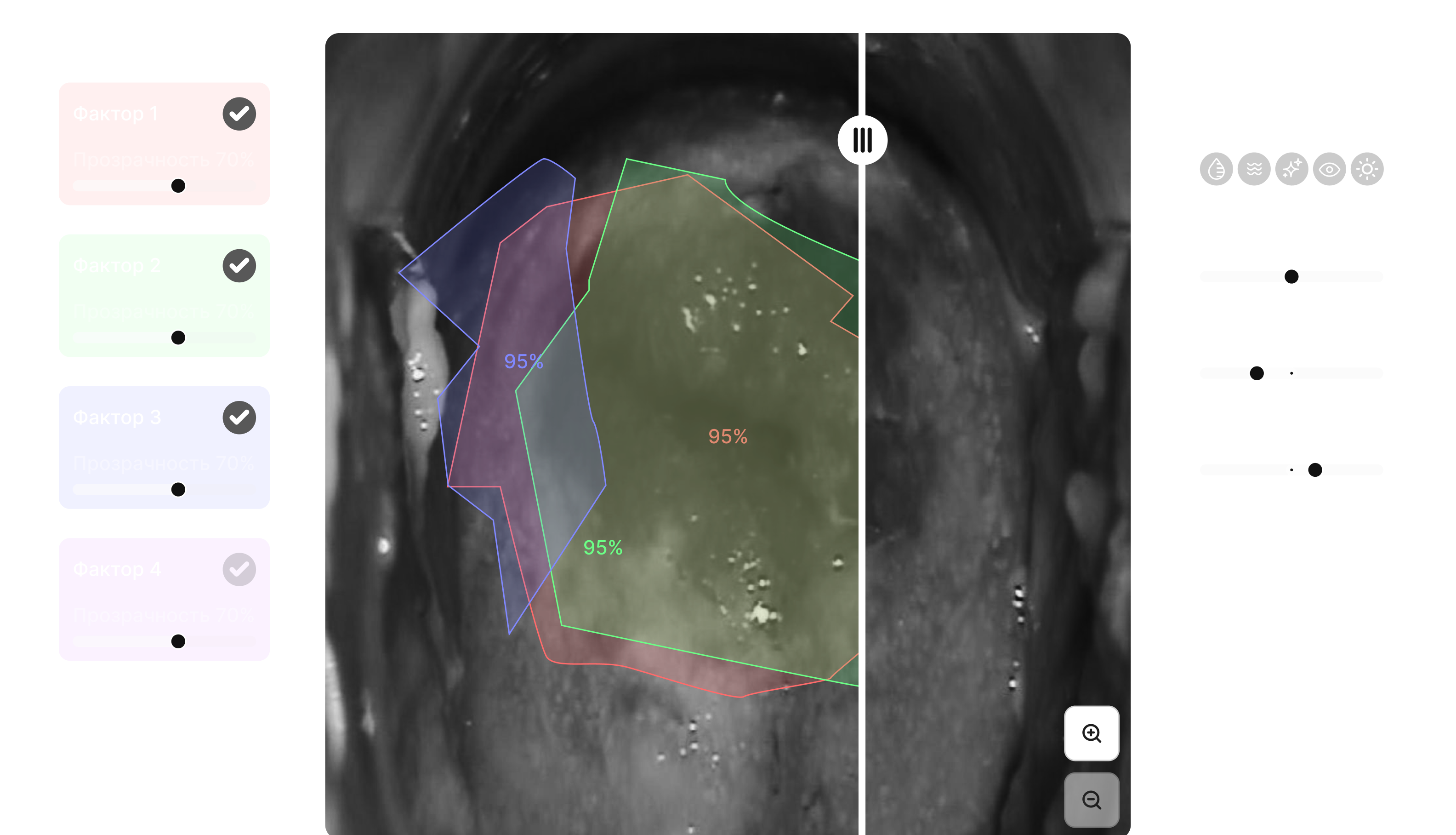 Интерфейс Procolpo
